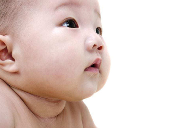 15 Simple Home Remedies For White Patches On Baby Face Active Moms Network Activities And 