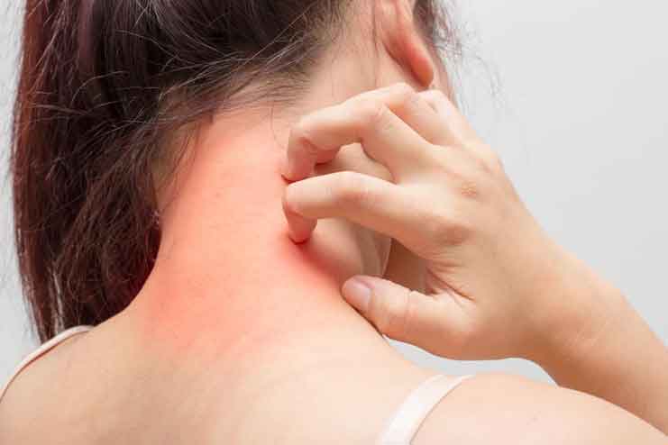 Causes-of-Itchy-Skin-during-Pregnancy