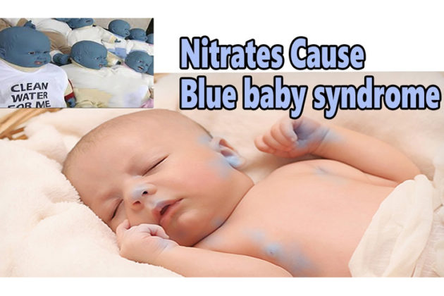 Blue Baby Syndrome Causes Treatment And Prevention